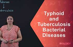 Typhoid and Tuberculo ...