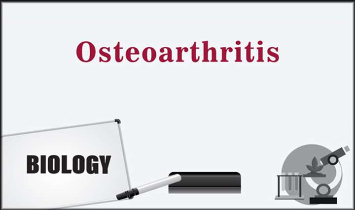 Osteoarthritis - 