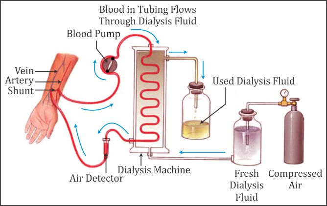 explain-the-concept-and-mechanism-of-dialysis-vsg0ee